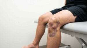 Dashboard Knee Injuries